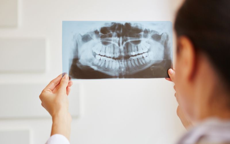 A woman is holding up an x-ray of her teeth, revealing mistakes.