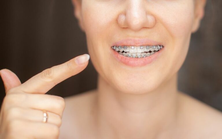 A woman with braces on her teeth, exploring why straighten your teeth?