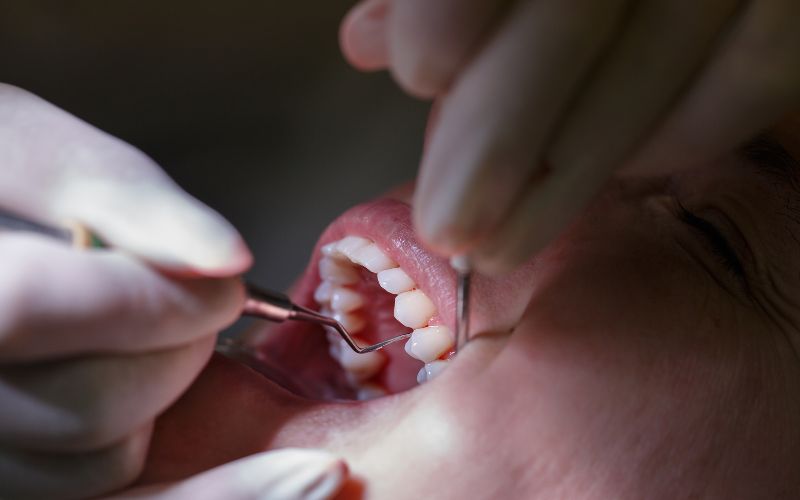 Patient dental office Treatment of periodontitis