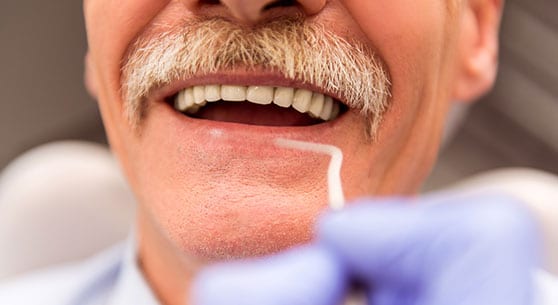old man having a teeth treatment in dental implant hamilton