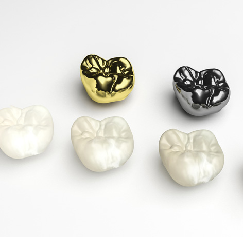 Custom dental crowns in shades of white, silver, and gold in dentist emergency hamilton