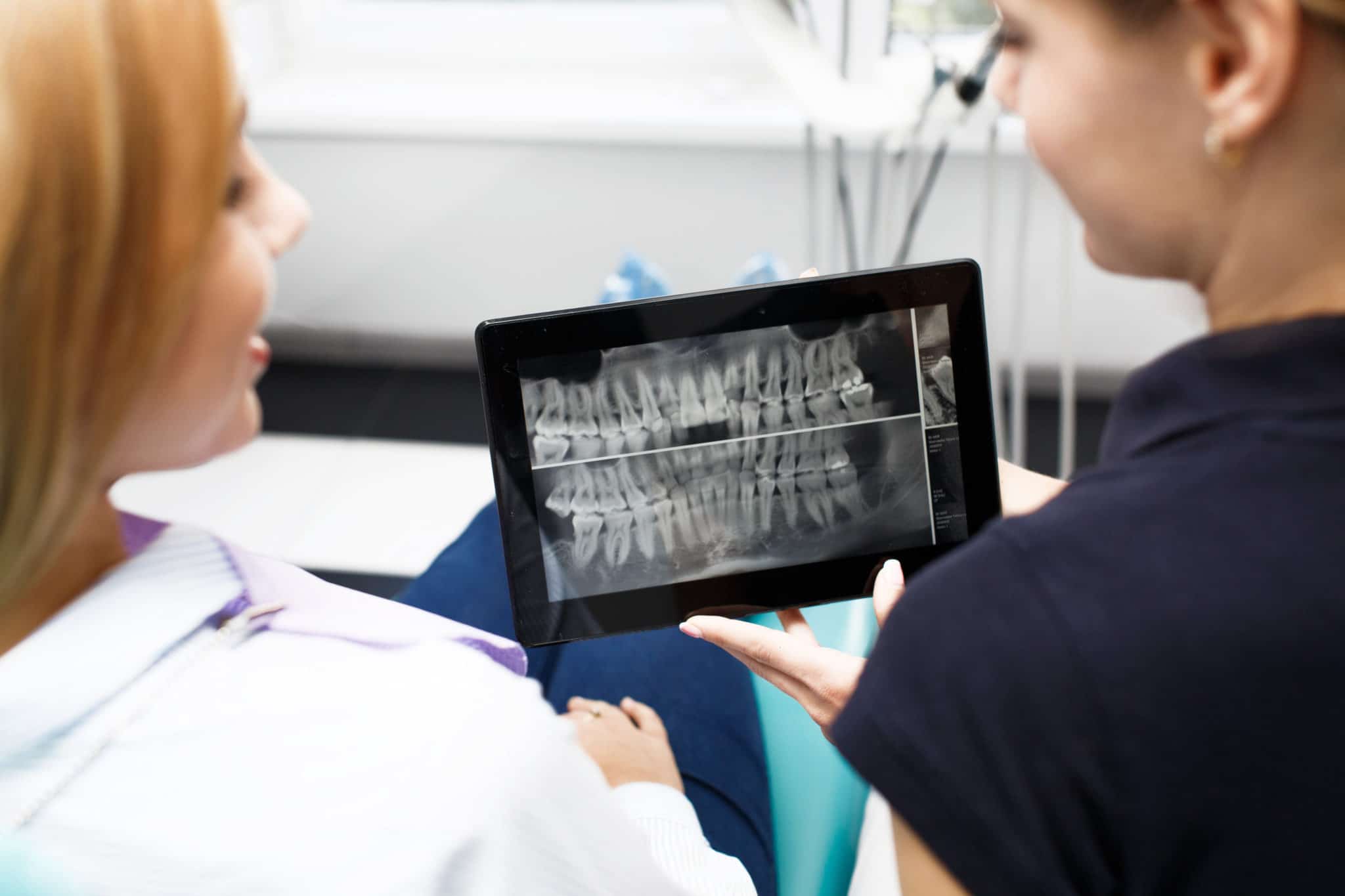 Dental hygienist showing dental x-ray to curious patient in hamilton cosmetic dentistry