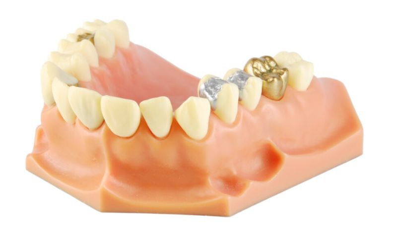 Dental fillings materials