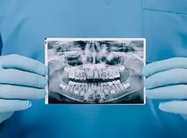 dentist holding a dental x-ray at dental office in hamilton