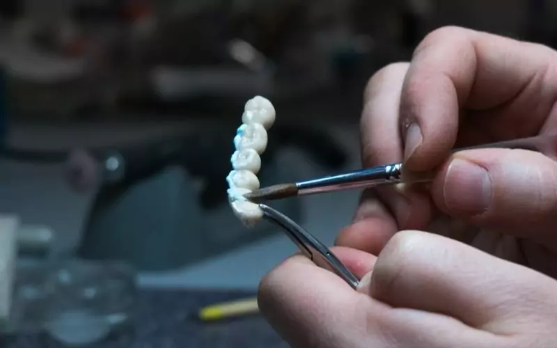 Benefits of same day crowns bridges