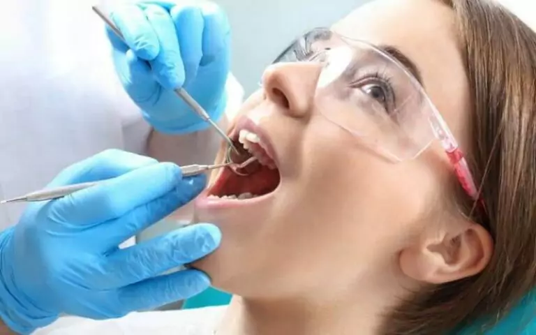 how long do composite fillings last
