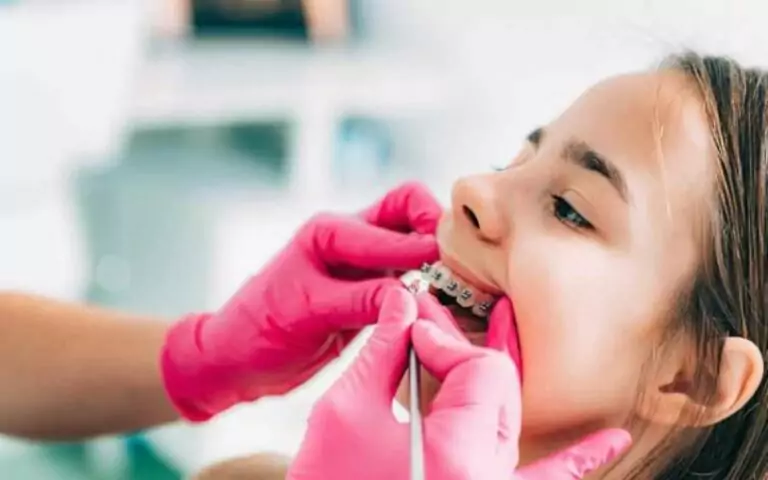 how dentists clean teeth with braces
